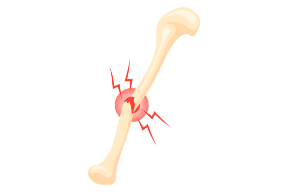 Broken Bone Icon: Graphics and Illustrations for Handmade Creators